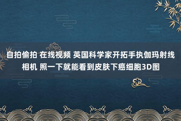 自拍偷拍 在线视频 英国科学家开拓手执伽玛射线相机 照一下就能看到皮肤下癌细胞3D图